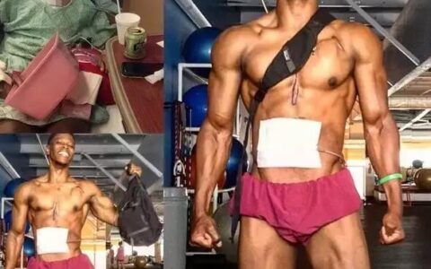 沒有“心臟”照樣堅持健身，這位27歲美國小伙我服！