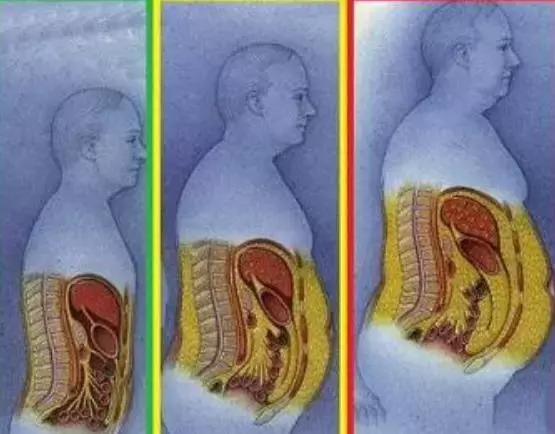 腹部脂肪危害有多大？看完嚇得我趕緊去減肥了